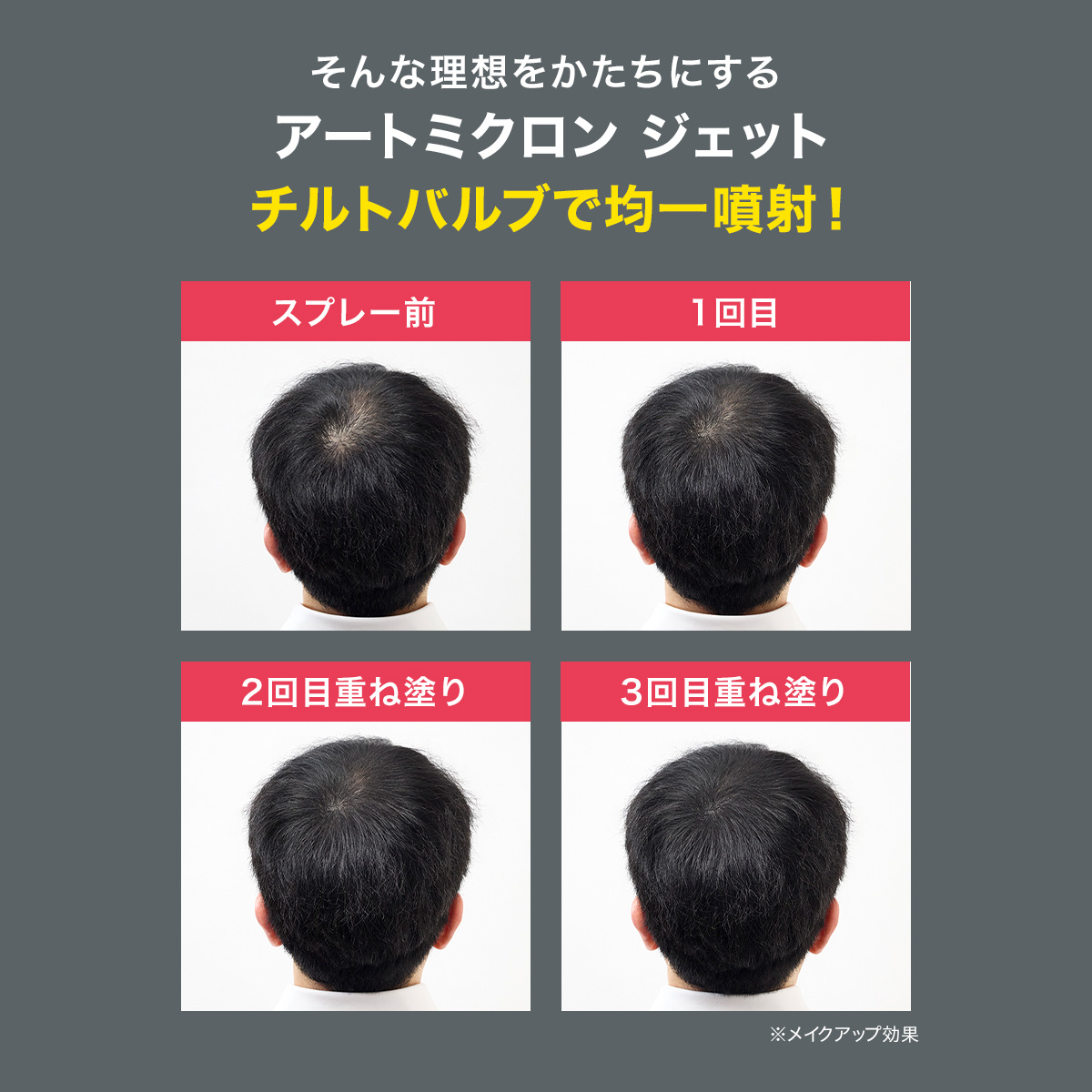 �A�[�g�~�N���� �W�F�b�g