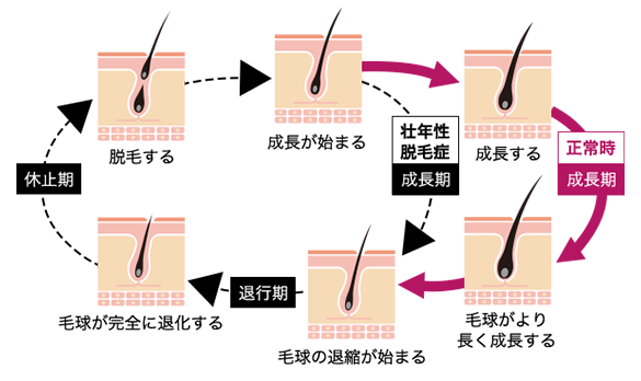 LABOMO(ラボモ) ヘアグロウ ハナミノキ【第1類医薬品